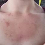 Red Is My Favorite Color… But Not On My Skin