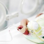 Premature Baby Preeclampsia | WIRL Project
