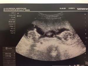 Twins Ultrasound | WIRL Project